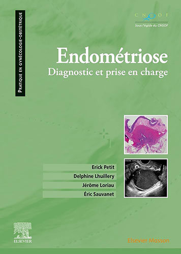 Endométriose